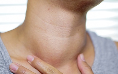 Những điều cần biết về bướu tuyến giáp 
