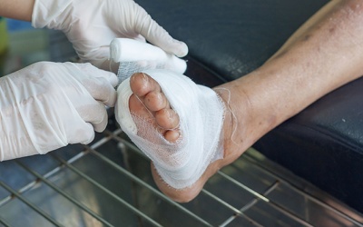 Mọi điều cần biết về nhiễm trùng bàn chân đái tháo đường