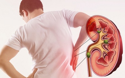 Một vài thói quen hàng ngày có thể dẫn đến chứng thận yếu