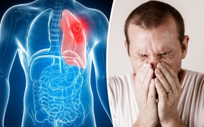 Dấu hiệu nhận biết u phổi ác tính và cách cải thiện 