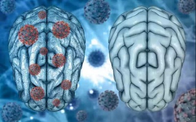 Làm gì để phòng tránh “sương mù não” hậu COVID-19?