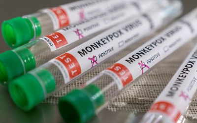 Tăng cường giám sát người về từ quốc gia đang có bệnh đậu mùa khỉ