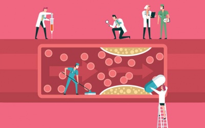 Chuyên gia cảnh báo: Tổn thương vi mạch gây thiếu máu cơ tim hậu COVID-19