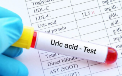Tăng acid uric máu nguy hiểm như thế nào?
