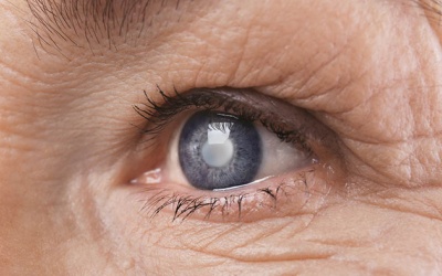 Bệnh võng mạc đái tháo đường: Biến chứng mắt nguy hiểm không nên coi thường