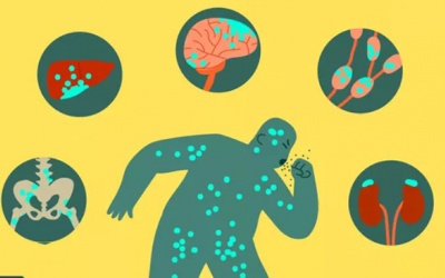 Ung thư phổi có thể di căn đến cơ quan nào?