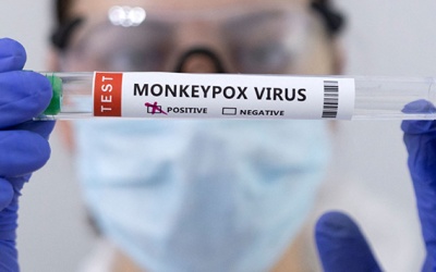 TP.HCM hướng dẫn xử trí khi phát hiện trường hợp nghi mắc đậu mùa khỉ