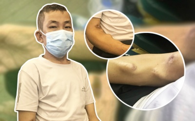 Vẫn lạc quan dù gần 20 năm 'sống chung' với máy chạy thận