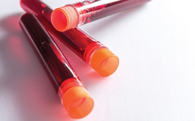 HbA1c 8% có nên dùng TPBVSK Glutex không?