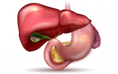 Sỏi mật 3,1mm nên dùng TPBVSK Kim Đởm Khang trong bao lâu?