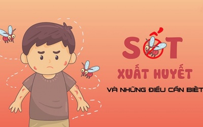 Nên làm gì khi bị sốt xuất huyết