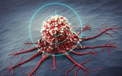 Theranostic - Niềm hy vọng cho những bệnh nhân ung thư di căn