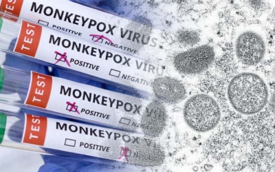 WHO tiếp tục xem xét tuyên bố tình trạng khẩn cấp với bệnh đậu mùa khỉ