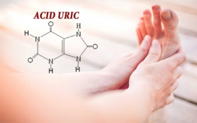 Mách bạn 6 cách giúp giảm acid uric tự nhiên ngay tại nhà
