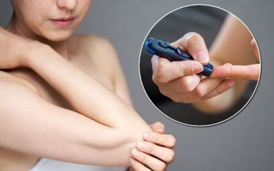 Đái tháo đường: 6 lời khuyên giúp ngăn ngừa các vấn đề về da