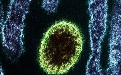 Virus Langya mới phát hiện ở Trung Quốc nguy hiểm thế nào?