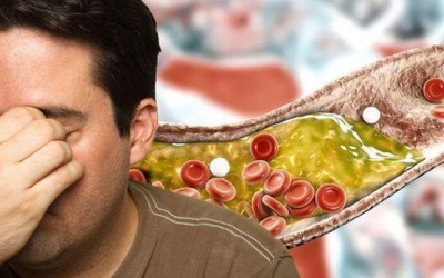 Mách bạn 5 cách giảm cholesterol tự nhiên