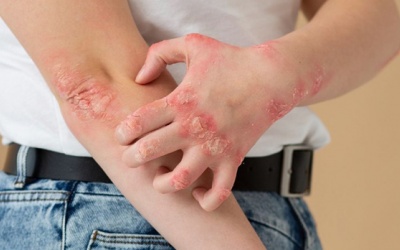 Mách bạn 7 mẹo chăm sóc da cho người đái tháo đường