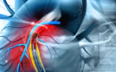 Biến chứng bệnh mạch vành đe dọa tính mạng 