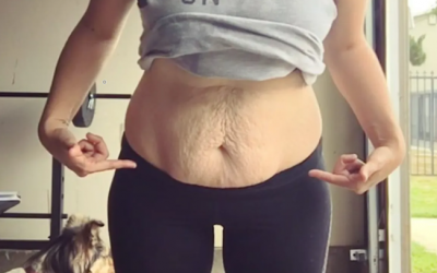 Một số lưu ý để ngăn ngừa da chảy xệ sau giảm cân