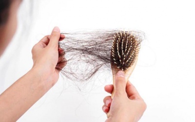 Chỉ ra những 'thủ phạm' khiến tóc bạn rụng nhiều 