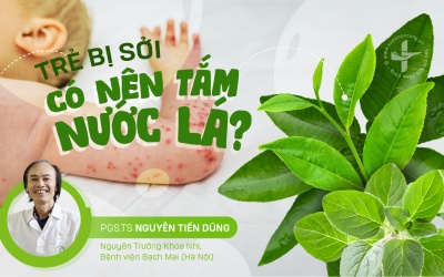 Có nên tắm nước lá cho trẻ khi bị sởi?