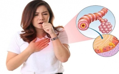 Dùng thuốc gì để cải thiện viêm phế quản? 