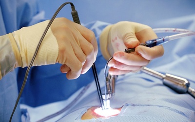 Phẫu thuật hở van tim 2 lá có nguy hiểm không và thường mất bao lâu?