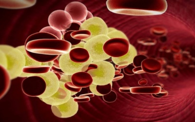 Kiểm soát máu nhiễm mỡ tại nhà