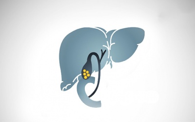 Sỏi túi mật 18,1mm nên uống thuốc hay phẫu thuật?