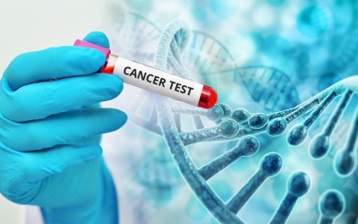 Tầm soát nhiều bệnh ung thư bằng một lần xét nghiệm: Những điều chưa chắc chắn