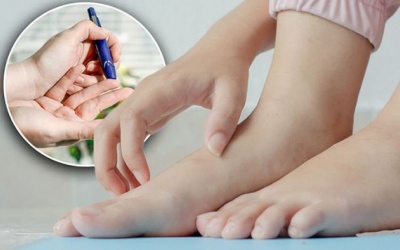 Da khô, ngứa ngáy có phải do biến chứng đái tháo đường không?