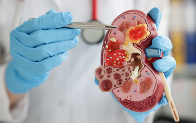 Infographic: Người bị suy thận không nên ăn gì? 