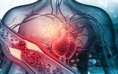 Bệnh máu nhiễm mỡ có chữa được không? 