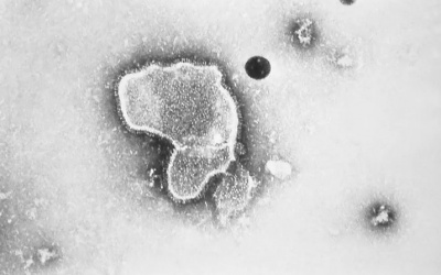 Pfizer phát triển vaccine RSV bảo vệ trẻ sơ sinh từ khi mang thai 