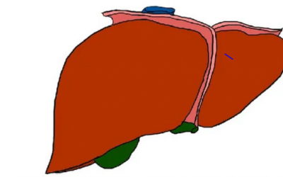 Những lầm tưởng về bệnh gan nhiễm mỡ