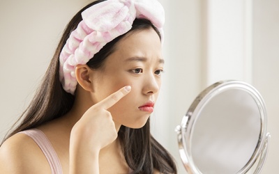 Những điều cần biết khi trị mụn trứng cá