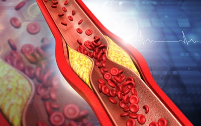 Bật mí cách giảm mỡ máu tại nhà đơn giản 