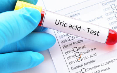 Cách giảm acid uric trong máu hiệu quả, an toàn