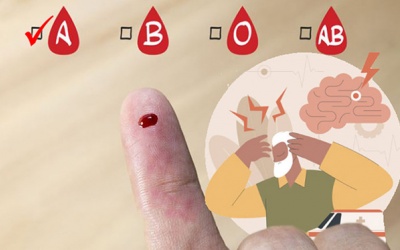 Nghiên cứu phát hiện nhóm máu có nguy cơ đột quỵ sớm