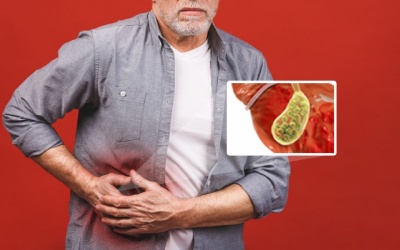 Có cách nào tan sỏi 7 - 9mm không cần cắt túi mật không?