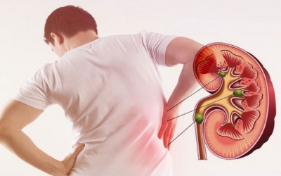 Triệu chứng suy thận mạn cần nhận biết sớm