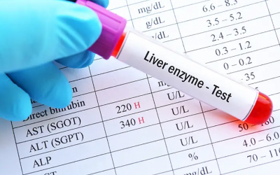 Cách hạ men gan ALT tự nhiên và hiệu quả