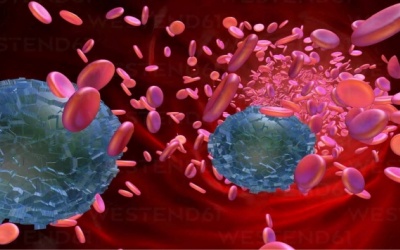 Phát hiện hạt vi nhựa trong mô tĩnh mạch người