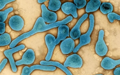 9 trường hợp tử vong do virus Marburg, WHO tiến hành họp khẩn 