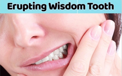 5 dấu hiệu bạn sắp mọc răng khôn