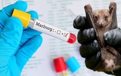 Virus Marburg: Những lần xuất hiện và nguy cơ xảy ra tại Việt Nam?
