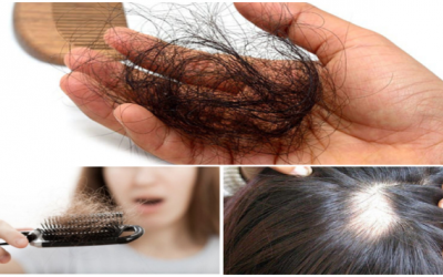 Chế độ ăn ảnh hướng tới sức khỏe mái tóc của bạn