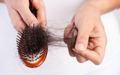 Thiếu ngủ có gây rụng tóc?