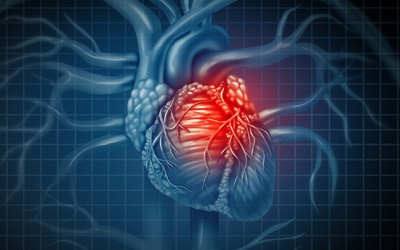 Bị cầu cơ mạch vành kèm mỡ máu cao phải làm sao?